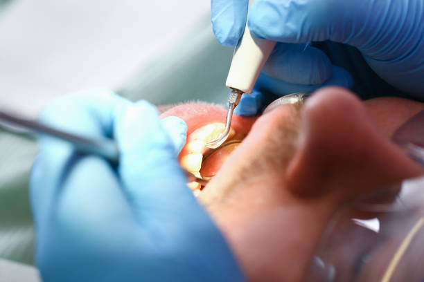 Best Same-Day Emergency Dentist in Grayvle, IL