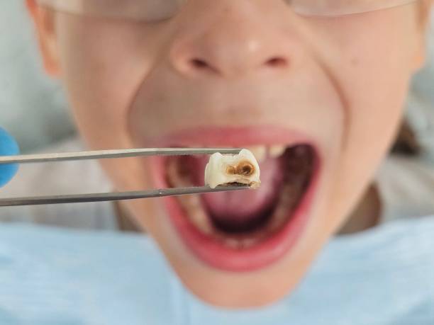 Best Walk-In Emergency Dentist in Grayvle, IL