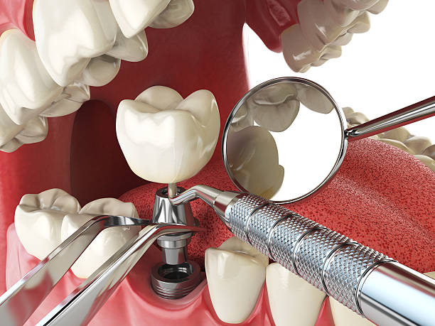 Best Emergency Treatment for Toothache in Grayvle, IL